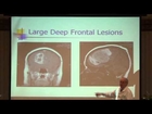 Technology, Radiology and Neurosurgery - Stephen Bloomfield, MD