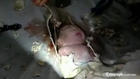 A baby stuck in a drain pipe in China
